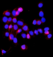 Immunofluorescent staining of FFPE human A431 cells with SHMT1 antibody (red) and DAPI nuclear stain (blue). HIER: steam section in pH6 citrate buffer for 20 min.