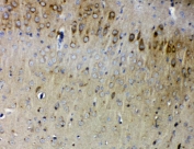 IHC staining of FFPE mouse brain with SYNPO antibody. HIER: boil tissue sections in pH8 EDTA for 20 min and allow to cool before testing.
