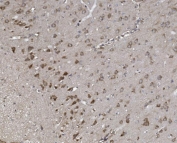 IHC staining of FFPE rat brain with SYNPO antibody. HIER: boil tissue sections in pH8 EDTA for 20 min and allow to cool before testing.