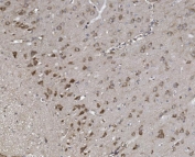 IHC staining of FFPE rat brain with SYNPO antibody. HIER: boil tissue sections in pH8 EDTA for 20 min and allow to cool before testing.