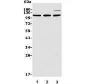 Western blot testing of 1) rat brain, 2) mouse brain and 3) human SH-SY5Y lysate with SYNPO antibody. Expected molecular weight ~99 kDa.