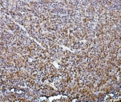 IHC staining of FFPE mouse intestinal lymph node with TEAD2 antibody. HIER: boil tissue sections in pH8 EDTA for 20 min and allow to cool before testing.