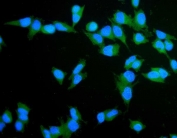 Immunofluorescent staining of FFPE human HeLa cells with TLN1 antibody (green) and DAPI nuclear stain (blue). HIER: steam section in pH6 citrate buffer for 20 min.