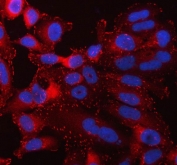 Immunofluorescent staining of FFPE human HeLa cells with TLN1 antibody (red) and DAPI nuclear stain (blue). HIER: steam section in pH6 citrate buffer for 20 min.