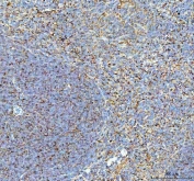 IHC staining of FFPE mouse spleen tissue with TLN1 antibody. HIER: boil tissue sections in pH8 EDTA for 20 min and allow to cool before testing.