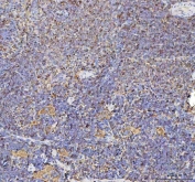 IHC staining of FFPE rat spleen tissue with TLN1 antibody. HIER: boil tissue sections in pH8 EDTA for 20 min and allow to cool before testing.
