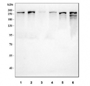 Western blot testing of 1) human HeLa, 2) human HepG2, 3) human Raji, 4) human 293T, 5) rat C6 and 6) mouse lung tissue lysate with TLN1 antibody. Predicted molecular weight ~275 kDa.