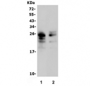 Western blot testing of 1) rat thymus and 2) mouse thymus lysate with Tnf alpha antibody. Predicted molecular weight: ~26 kDa.