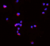 Immunofluorescent staining of FFPE mouse HEPA1-6 cells with Tnf alpha antibody (red) and DAPI nuclear stain (blue). HIER: steam section in pH6 citrate buffer for 20 min.