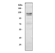 Western blot testing of human K562 cell lysate with TNFRSF8 antibody. Predicted molecular weight: 53-120 kDa depending on glycosylation level.