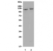 Western blot testing of mouse 1) RAW264.7 and 2) ANA-1 lysate with TNFRSF8 antibody. Predicted molecular weight: 53-120 kDa depending on glycosylation level.