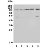 Western blot testing of 1) human HEK293, 2) rat PC-3, 3) rat C6, 4) mouse brain and 5) mouse testis lysate with TRPV4 antibody. Expected molecular weight: 90-110 kDa depending on level of glycosylation.