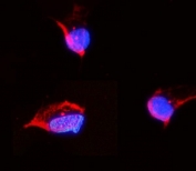 Immunofluorescent staining of FFPE rat NRK cells with TUBA1A antibody (red) and DAPI nuclear stain (blue). HIER: steam section in pH6 citrate buffer for 20 min.