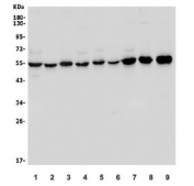 Western blot testing of human 1) HeLa, 2) Jurkat, 3) HEK293, 4) HepG2, 5) SW620, 6) Raji, 7) K562, 8) rat brain and 9) mouse brain lysate with TUBA1A antibody. Predicted molecular weight ~50 kDa.