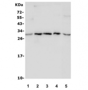 Western blot testing of 1) rat lung, 2) mouse brain, 3) mouse heart, 4) mouse lung and 5) human HepG2 lysate with ULBP1 antibody. Predicted molecular weight ~28 kDa.
