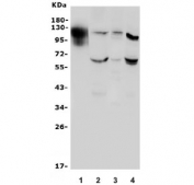 Western blot testing of 1) mouse kidney, 2) human HEK293, 3) monkey kidney and 4) rat PC-12 lysate with Uromodulin antibody. Expected molecular weight: 70-105 kDa depending on level of glycosylation.