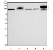 Western blot testing of 1) human 293T, 2) rat kidney, 3) rat NRK, 4) rat PC-12 and 5) mouse kidney tissue lysate with Uromodulin antibody. Expected molecular weight: 70-105 kDa depending on level of glycosylation.
