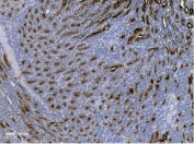 IHC staining of FFPE rat kidney with Uromodulin antibody. HIER: boil tissue sections in pH8 EDTA for 20 min and allow to cool before testing.