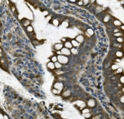 IHC staining of FFPE rat intestine with UNG antibody. HIER: boil tissue sections in pH8 EDTA for 20 min and allow to cool before testing.