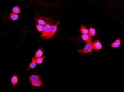 Immunofluorescent staining of FFPE human MCF7 cells with UNG antibody (red) and DAPI nuclear stain (blue). HIER: steam section in pH6 citrate buffer for 20 min.