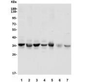Western blot testing of human 1) HeLa, 2) Jurkat, 3) SW620, 4) HEK293, 5) monkey heart, 6) rat heart and 7) mouse heart lysate with UNG antibody. Predicted molecular weight ~35 kDa.