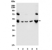 Western blot testing of human 1) HeLa, 2) HepG2, 3) HEK293, 4) rat PC-12 and 5) mouse NIH 3T3 lysate with RENT3A antibody. Predicted molecular weight ~51 kDa.