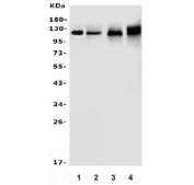 Western blot testing of 1) human MCF7, 2) human A549, 3) rat liver and 4) mouse lung lysate with XPC antibody. Predicted molecular weight ~106 kDa.