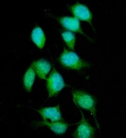 Immunofluorescent staining of FFPE human HeLa cells with XPC antibody (green) and DAPI nuclear stain (blue). HIER: steam section in pH6 citrate buffer for 20 min.