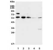 Western blot testing of rat 1) heart, 2) lung, 3) PC-12, 4) mouse heart and 5) mouse lung lysate with Xrcc4 antibody. Predicted molecular weight: 35-38/55 kDa (unmodified/phosphorylated).