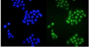 Immunofluorescent staining of FFPE human A431 cells with ZBTB16 antibody (green) and DAPI nuclear stain (blue). HIER: steam section in pH6 citrate buffer for 20 min.