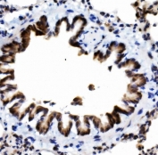 IHC staining of FFPE rat lung with MCPIP1 antibody. HIER: boil tissue sections in pH8 EDTA for 20 min and allow to cool before testing.