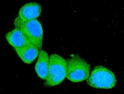 Immunofluorescent staining of FFPE human MCF7 cells with S100A4 antibody (green) and DAPI nuclear stain (blue). HIER: steam section in pH6 citrate buffer for 20 min.