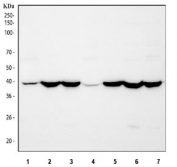 Western blot testing of 1) human HepG2, 2) rat kidney, 3) rat liver, 4) rat NRK, 5) mouse kidney, 6) mouse liver and 7) mouse HEPA1-6 cell lysate with ACADS antibody. Predicted molecular weight ~44 kDa.