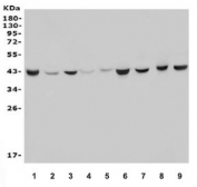 Western blot testing of human 1) HeLa, 2) A549, 3) U-87 MG, 4) HepG2, 5) HEK293, 6) rat liver, 7) rat kidney, 8) mouse liver and 9) mouse kidney lysate with ACADS antibody. Predicted molecular weight ~44 kDa.