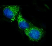 Immunofluorescent staining of FFPE human MCF7 cells with ACADS antibody (green) and DAPI nuclear stain (blue). HIER: steam section in pH6 citrate buffer for 20 min.