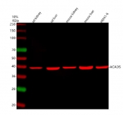 Western blot testing of 1) rat kidney, 2) rat liver, 3) mouse kidney, 4) mouse liver and 5) mouse HEPA1-6 cell lysate with ACADS antibody and DyLight 647 conjugated secondary. Predicted molecular weight ~44 kDa.