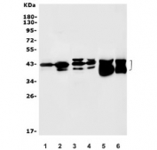 Western blot testing of 1) human A431, 2) human T-47 D, 3) human A549, 4) monkey COS-7, 5) rat liver and 6) mouse liver lysate with ACADSB antibody. Expected molecular weight: ~47 kDa (unprocessed), ~43 kDa (processed).