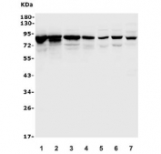 Western blot testing of rat 1) heart, 2) liver, 3) kidney, 4) spleen and mouse 5) spleen, 6) thymus and 7) ANA-1 lysate with Afm antibody. Predicted molecular weight: ~69/87 kDa (unmodified/glycosylated).