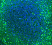 Immunofluorescent staining of FFPE rat spleen with Cd2 antibody (green) and DAPI nuclear stain (blue). HIER: boil tissue sections in pH8 EDTA for 20 min and allow to cool before testing.