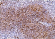 IHC staining of FFPE mouse spleen with Cd2 antibody. HIER: boil tissue sections in pH8 EDTA for 20 min and allow to cool before testing.