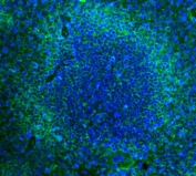 Immunofluorescent staining of FFPE mouse spleen with Cd2 antibody (green) and DAPI nuclear stain (blue). HIER: boil tissue sections in pH8 EDTA for 20 min and allow to cool before testing.