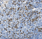IHC staining of FFPE human tonsil with CD38 antibody. HIER: boil tissue sections in pH8 EDTA for 20 min and allow to cool before testing.
