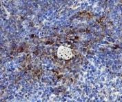 IHC staining of FFPE mouse spleen with Cd59 antibody. HIER: boil tissue sections in pH8 EDTA for 20 min and allow to cool before testing.