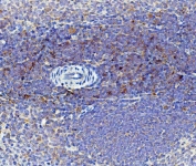 IHC staining of FFPE rat spleen with Cd59 antibody. HIER: boil tissue sections in pH8 EDTA for 20 min and allow to cool before testing.
