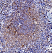 IHC staining of FFPE rat spleen with Cd63 antibody. HIER: boil tissue sections in pH8 EDTA for 20 min and allow to cool before testing.