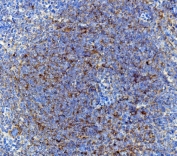IHC staining of FFPE mouse spleen with Cd63 antibody. HIER: boil tissue sections in pH8 EDTA for 20 min and allow to cool before testing.