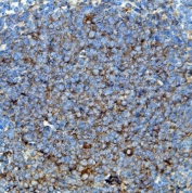 IHC staining of FFPE mouse spleen with Cd63 antibody. HIER: boil tissue sections in pH8 EDTA for 20 min and allow to cool before testing.