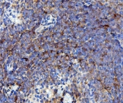 IHC staining of FFPE rat spleen with Cd63 antibody. HIER: boil tissue sections in pH8 EDTA for 20 min and allow to cool before testing.