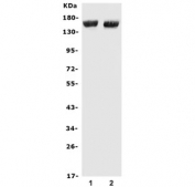 Western blot testing of 1) mouse liver and 2) rat liver lysate with Cfh antibody. Predicted molecular weight ~139 kDa but may be observed at a higher molecular weight due to glycosylation.