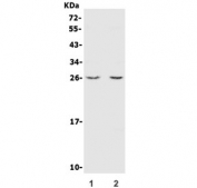 Western blot testing of mouse 1) lung and 2) RAW264.7 lysate with CINP antibody. Predicted molecular weight ~26 kDa.